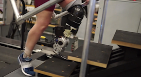 Prima gamba bionica interamente guidata dal cervello