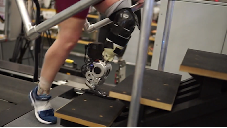 Prima gamba bionica interamente guidata dal cervello