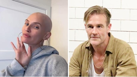 Tumore tra i giovani, da Bianca Balti a Van Der Beek: “Chiamano il cancro per nome e così aiutano la prevenzione”