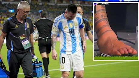 Come sta Messi dopo l'infortunio alla caviglia nella finale di Copa America Argentina-Colombia
