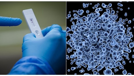 Influenza australiana o Covid? Sintomi, differenze e come distinguerli. Vaia: «Virus respiratori pericolosi»