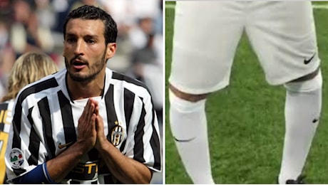 Zambrotta e le gambe curve: «I chirurghi si chiedono come faccia a camminare. Mi opero, poi dovrò mettere una protesi totale»