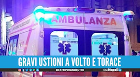 Si dà fuoco dopo la lite con la fidanzata: 23enne in pericolo di vita a Roma