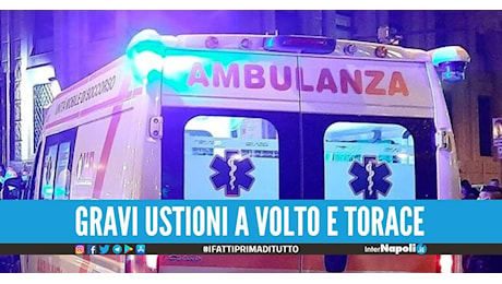 Si dà fuoco dopo la lite con la fidanzata: 23enne in pericolo di vita a Roma