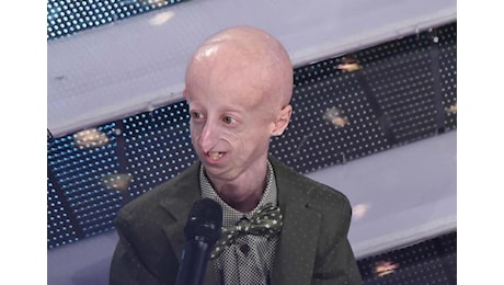 Sammy Basso è morto a 28 anni, il biologo veneto era affetto da progeria