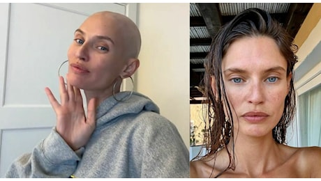 Bianca Balti per la prima volta senza capelli: «Sempre una “bad bitch”». Come sta dopo tumore e chemio