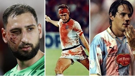 Gli infortuni choc dei calciatori: da Donnarumma a Chiellini, ai fratelli Inzaghi. Ferite, sangue e sfregi permanenti