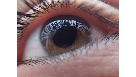 Retinopatia diabetica, cos’è il killer silenzioso dei nostri occhi